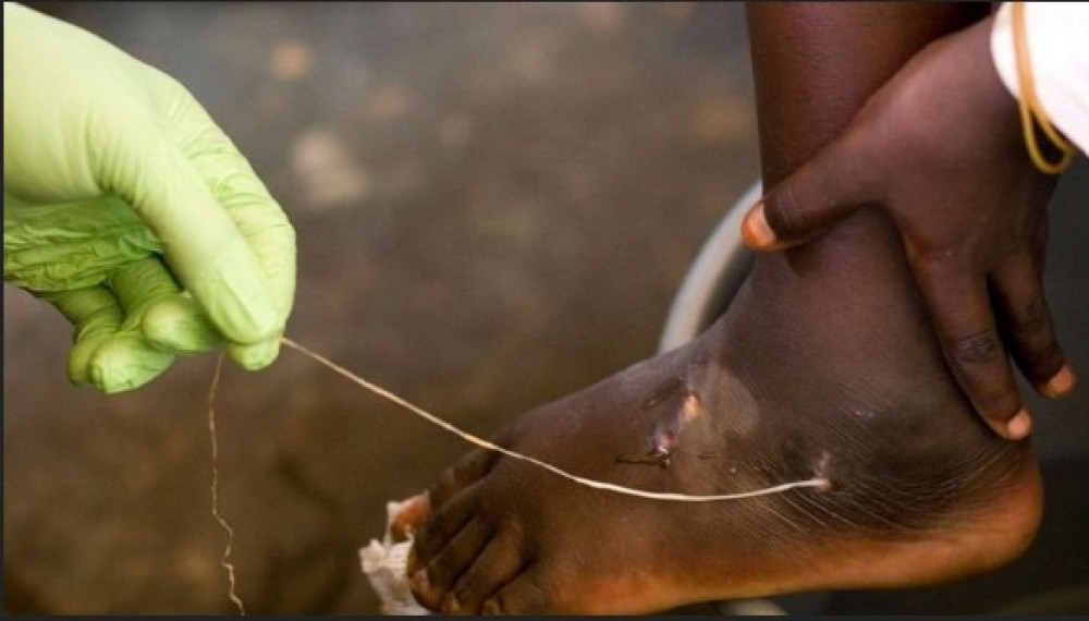 Lutte contre les maladies tropicales négligées (MTN)